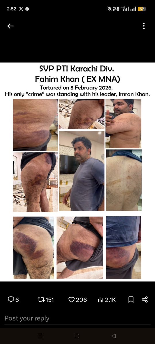 فہیم خان کا قصور یہ ہے کہ اس نے وزیراعلی سہیل آفریدی کے دورہ کراچی کو کامیاب کیوں بنایا کیوں لوگوں کو موبلائز کیا 
ظالم کا ظلم عروج پر ہے