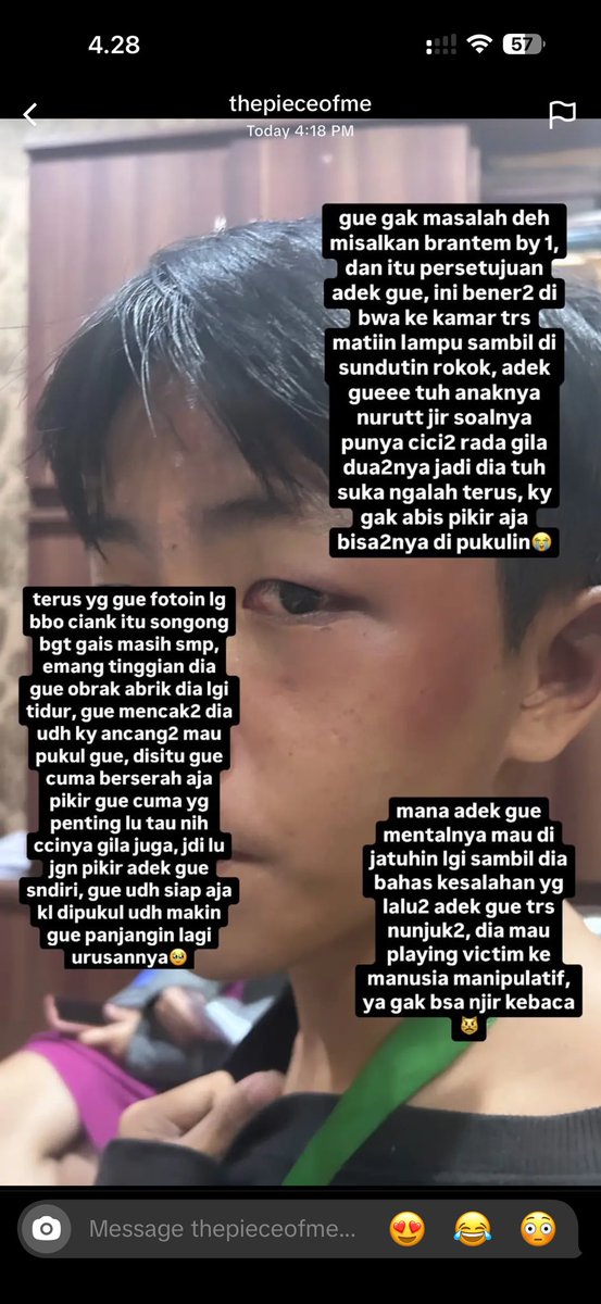 HELP RT‼️ 

‼️ KASUS PENGEROYOKAN DAN PENGANIAYAAN ‼️ 

gais minta tolong untuk bantu up kasus adeknya tmnku karna belum dpt keadilan

[ text dari jenni ] Saya selaku kakak dari James, korban pengeroyokan dan penganiayaan yang dilakukan oleh Nur Rizky Faith Pratama, Joshua, Arif