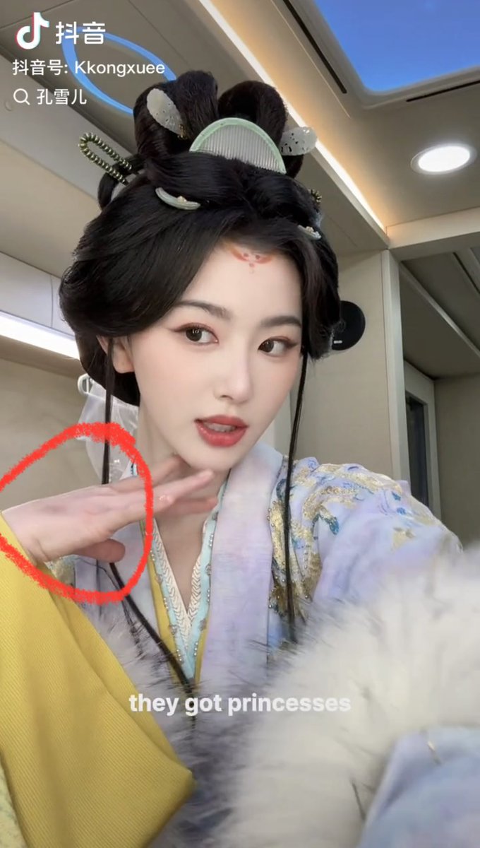 ให้น้ำเกลือจนเส้นเลือดช้ำไปหมดแล้ว สงสารมันอ่ะ😭 แต่ดูมันดิ มาเล่นดุ๊กดิ๊กๆให้ทุกคนหายห่วงอ่ะ มันรู้ว่าเสว่ฮวาห่วงมันจะตายแล้ว รักมันจังไอ่อ้วมของแม่