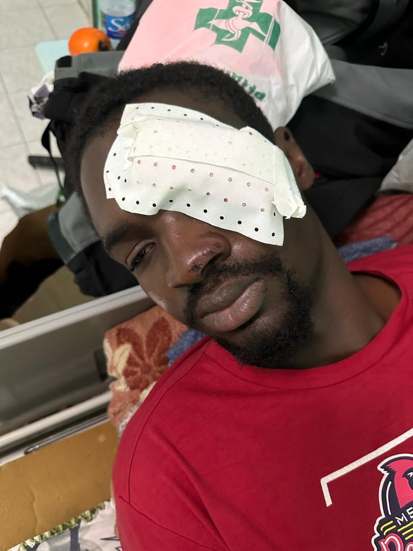 Ils vont jamais montrer ça devant les caméras 

Deux étudiants qui ont perdu  chacun un œil 

#Justice pour ces étudiants