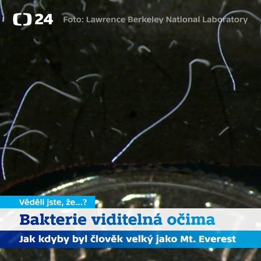 Největší bakterie na světě může dorůstat až do velikosti 1 cm, je tak asi 5 000x větší než průměrní mikrobi. Na rozdíl od nich je tak viditelná i bez mikroskopu.
Připomíná tenké vlákno nebo špagetu, dostala název Thiomargarita magnifica.