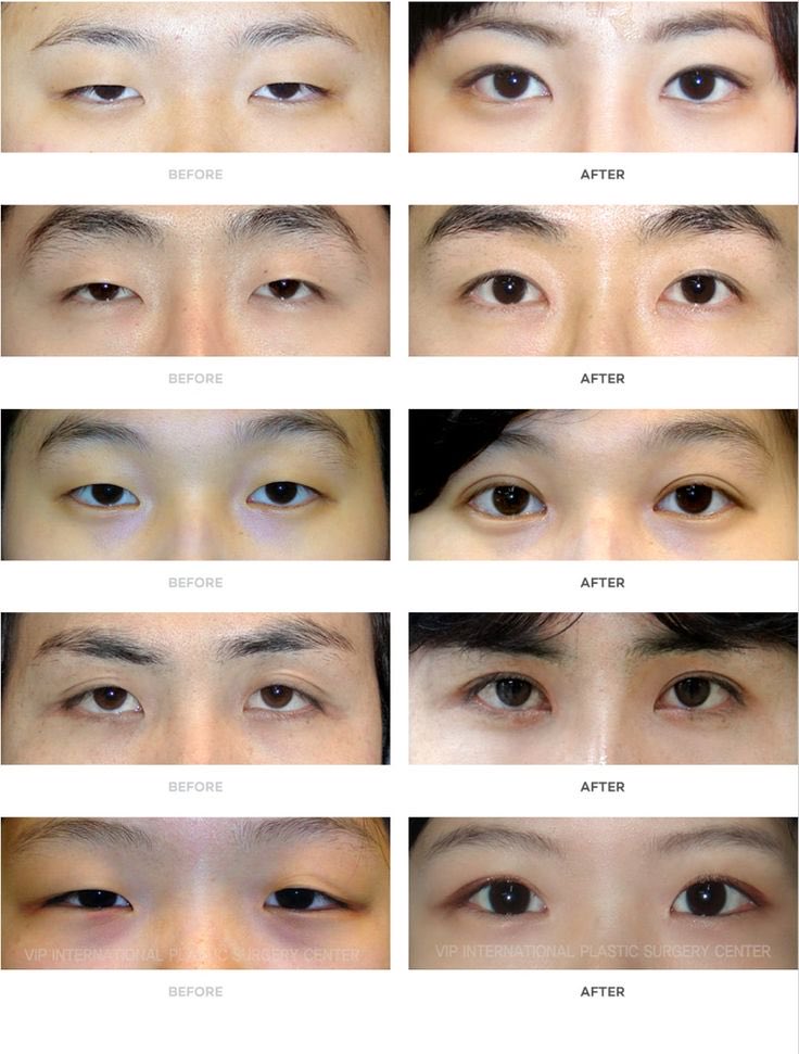 ntyrrrr's tweet photo. Said people need surgery to open their eyes… https://t.co/GmWbCm4zdZ