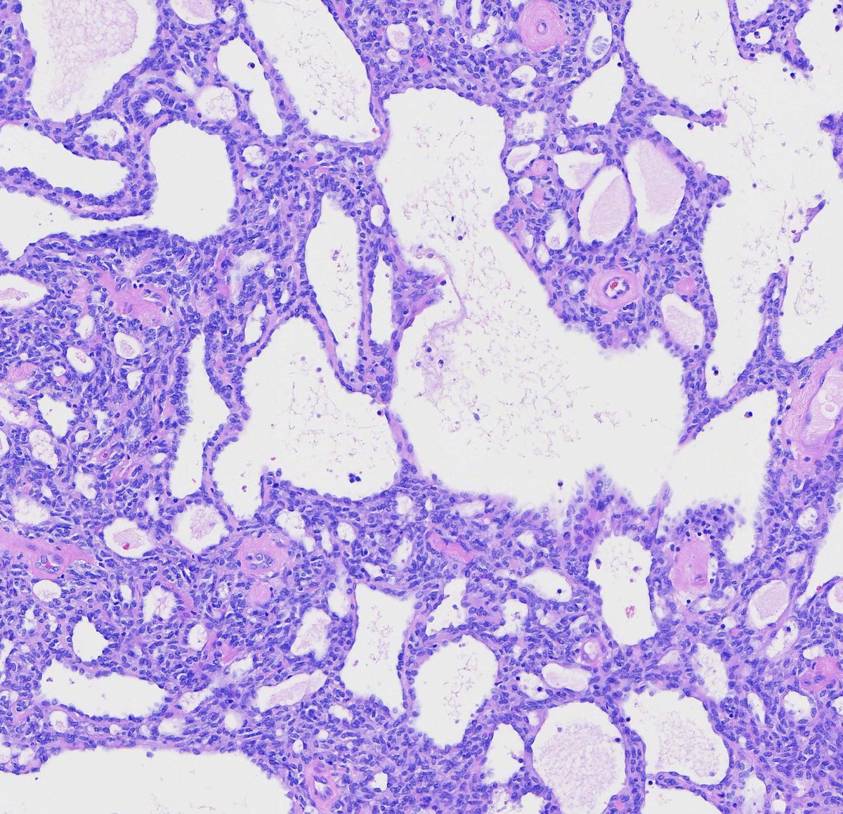 Toby Schmitt, MD tweet media