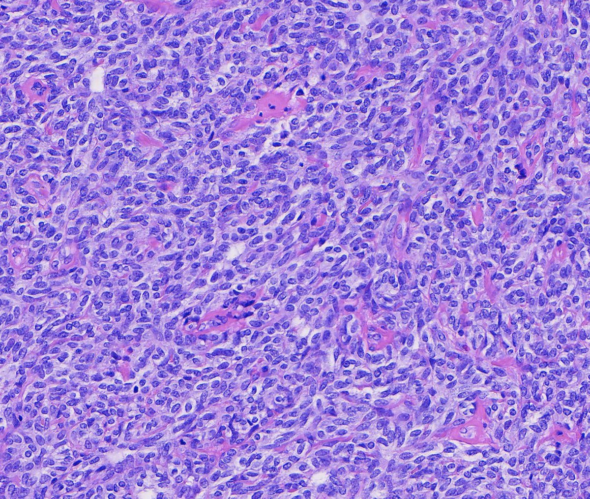 Toby Schmitt, MD tweet media