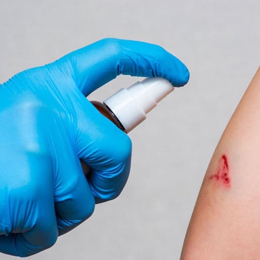 LMPositif's tweet photo. 🏥 Une équipe de chercheurs sud-coréens a créé un spray capable de gélifier le sang quasi instantanément. S’il passe les essais cliniques, il pourrait révolutionner la prise en charge en médecine d’urgence en stoppant les hémorragies en quelques secondes, sans devoir comprimer la plaie.👏(SciencePost)