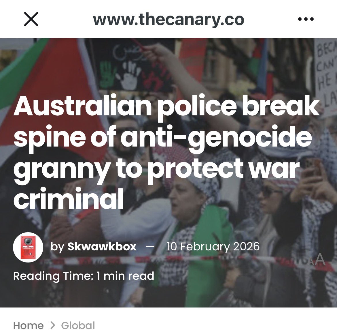 Unbelievable…. 

And Zionists still wonder why they are hated