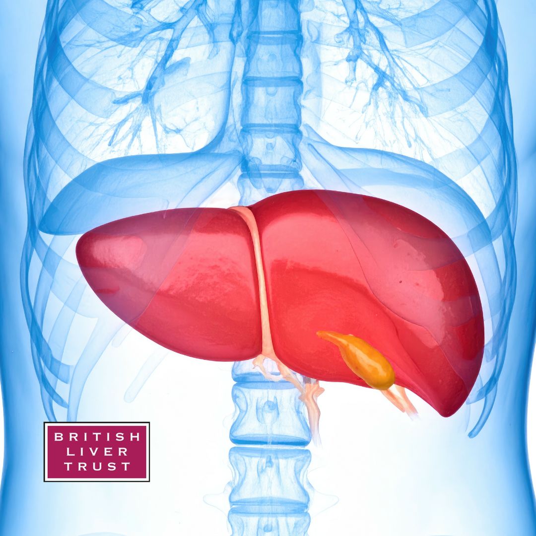 LiverTrust's tweet photo. February is Gall Bladder and Bile Duct Cancer Awareness Month. While the cause of most cases of bile duct cancer is unknown, being diagnosed with a liver disease, being overweight or diabetic may increase the risk. 

https://t.co/51GGozZEWX https://t.co/b51vOU3ZRQ