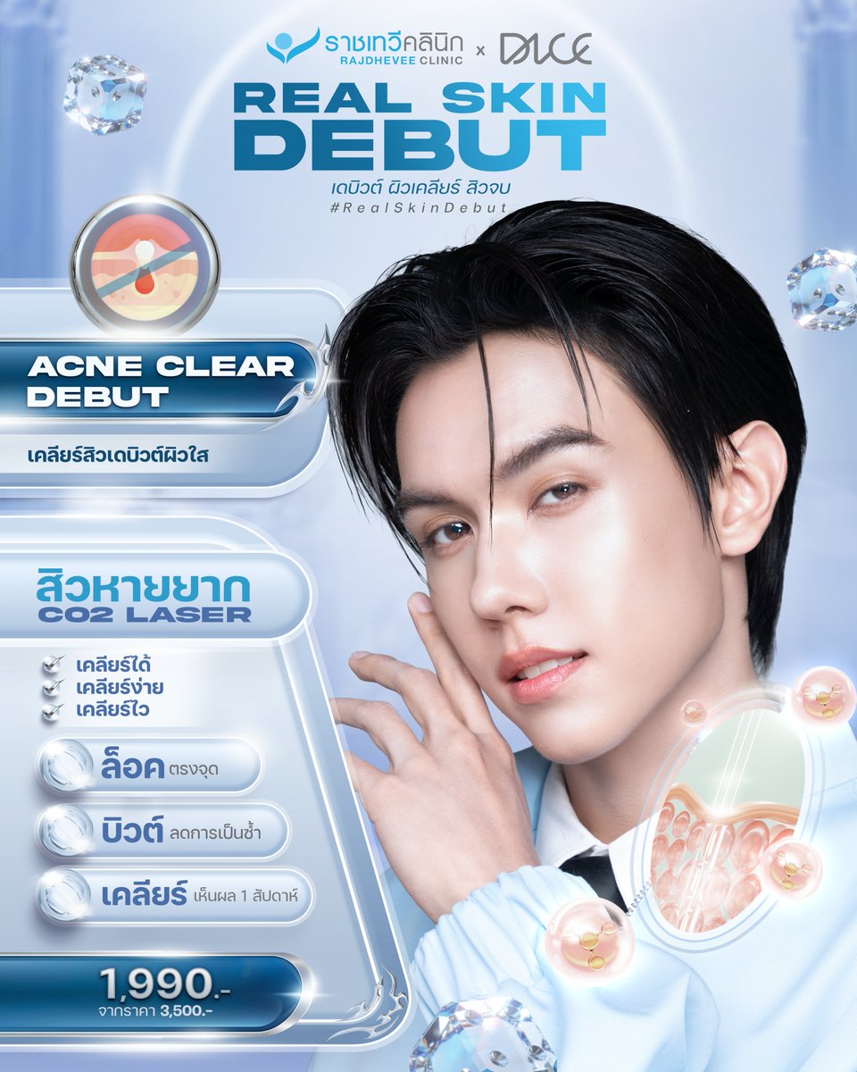 RCSkinClinic's tweet photo. Rajdhevee Clinic x DICE เปิดตัว Package Acne Clear Debut 
สุดคุ้ม! กับน้องอเล็กซ์ ที่จะมาโชว์ผิวใสไร้สิว กับราชเทวีคลินิก
เคลียร์สิวแบบถูกวิธี โดยแพทย์ผู้เชี่ยวชาญด้านสิว ด้วยนวัตกรรม CO₂ Laser ช่วยเปิดผิว เคลียร์สิวที่ฝังลึกได้อย่างตรงจุด
PACKAGE : ACNE CLEAR DEBUT ได้อะไรบ้าง?
 ราคาพิเศษเพียง 1,990 บาท (จากปกติ 3,550 บาท) 

- Comedone Minimizer 1 ขวด
- Acne Clear Lotion 1 ขวด
- V Block 1 หลอด
- Erythema Treatment 1 ครั้ง
- กดสิว CO₂ Laser (ไม่เกิน 10 จุด) 1 ครั้ง
- ตรวจผิว Triple S Test

สำหรับใครที่มีปัญหาสิว และอยากเริ่มต้นเดบิวต์ผิวใสอย่างถูกวิธี Acne Clear Debut คือจุดเริ่มต้นที่ใช่
ชาวไพร์ซ ที่อยากเดบิวต์ผิวไปพร้อมกับ อเล็กซ์ โอโบ และ เจย์ เพียงซื้อแพ็กเกจ และนำใบเสร็จมาร่วมกิจกรรม
Rajdhevee Clinic x DICE : Real Skin Debut ลุ้นเป็น Lucky Fans เข้าร่วมงาน Special Event Glow Your Stage 
เปิดผิวใสให้ได้กรี๊ดฉ่ำ ๆ พร้อมกิจกรรมสุดพิเศษภายในงาน แค่ร่วมกิจกรรมก็มีสิทธิ์ลุ้นทันที!
ดูรายละเอียดกิจกรรมเพิ่มเติมได้ที่ เว็บไซต์ หรือ Facebook Page : ราชเทวีคลินิก Rajdhevee Clinic