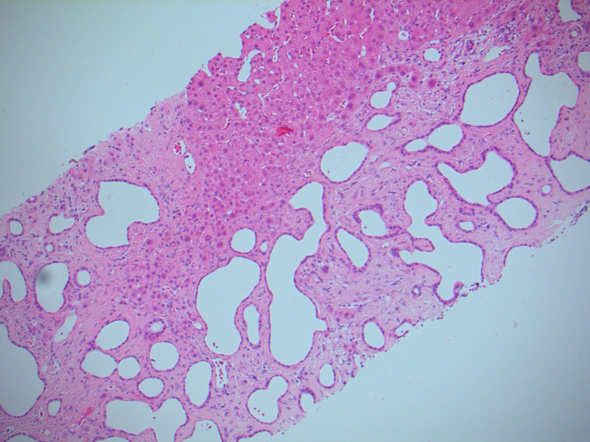 Tim Bracey tweet media