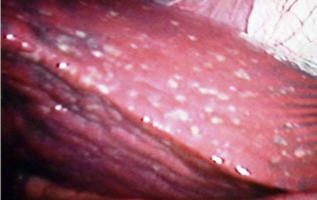 Tim Bracey tweet media