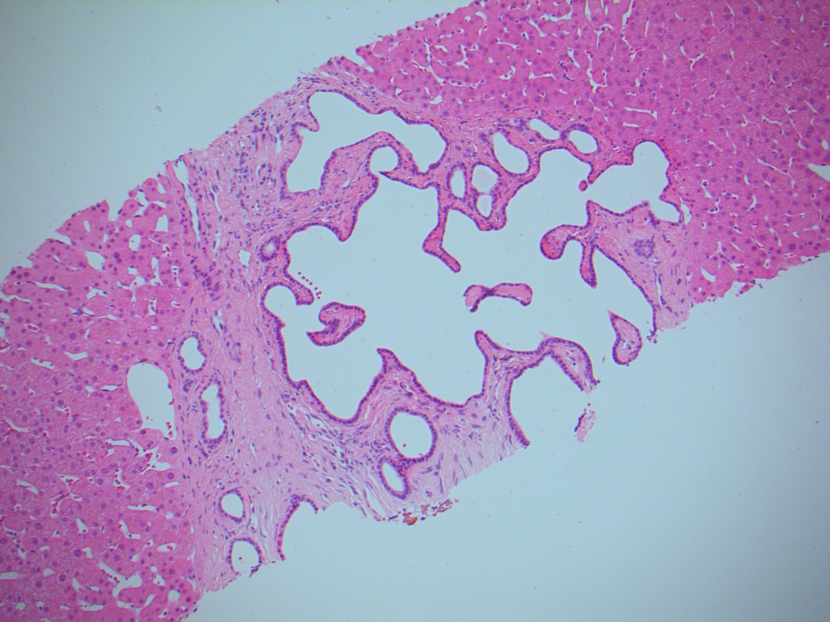 Tim Bracey tweet media