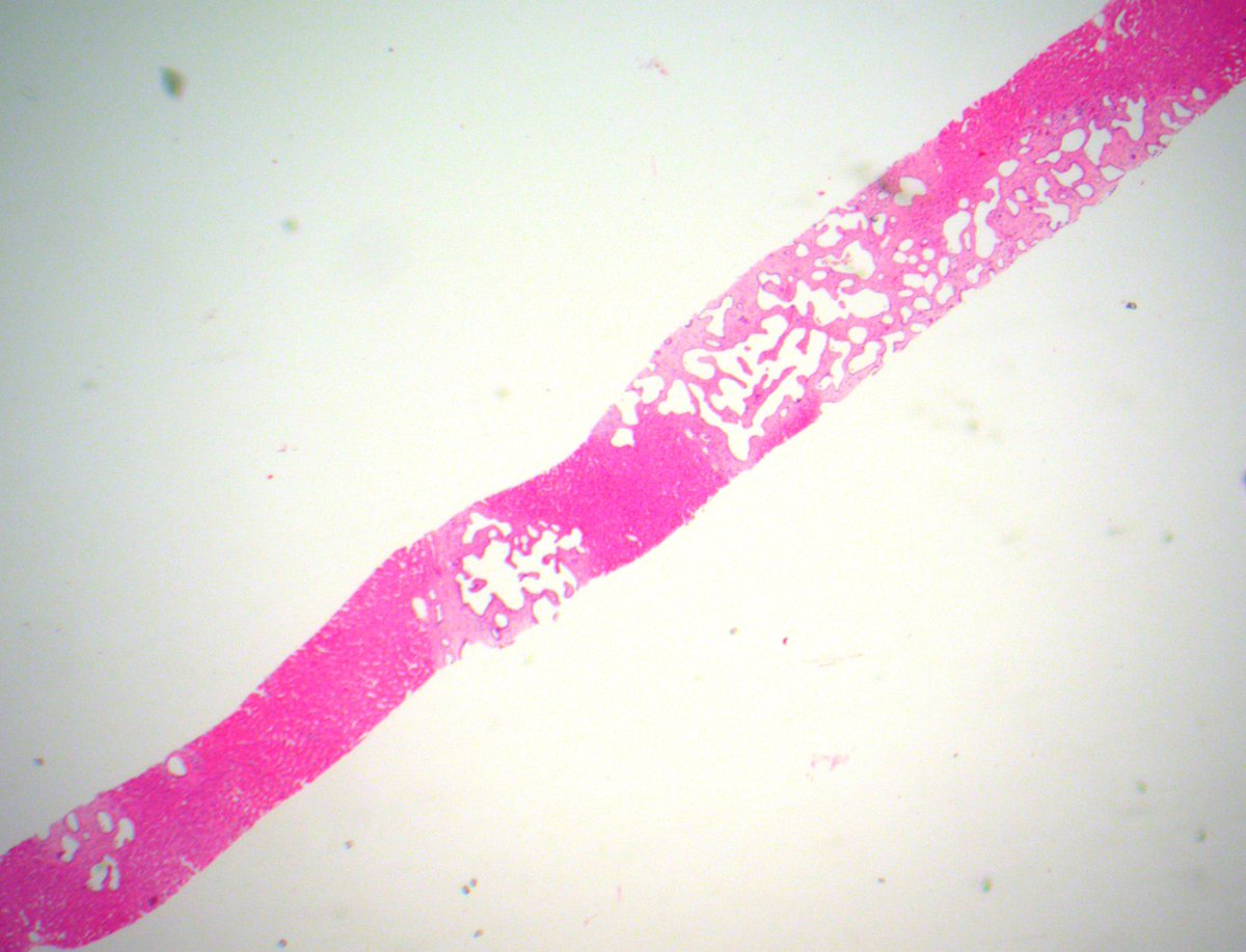 Tim Bracey tweet media