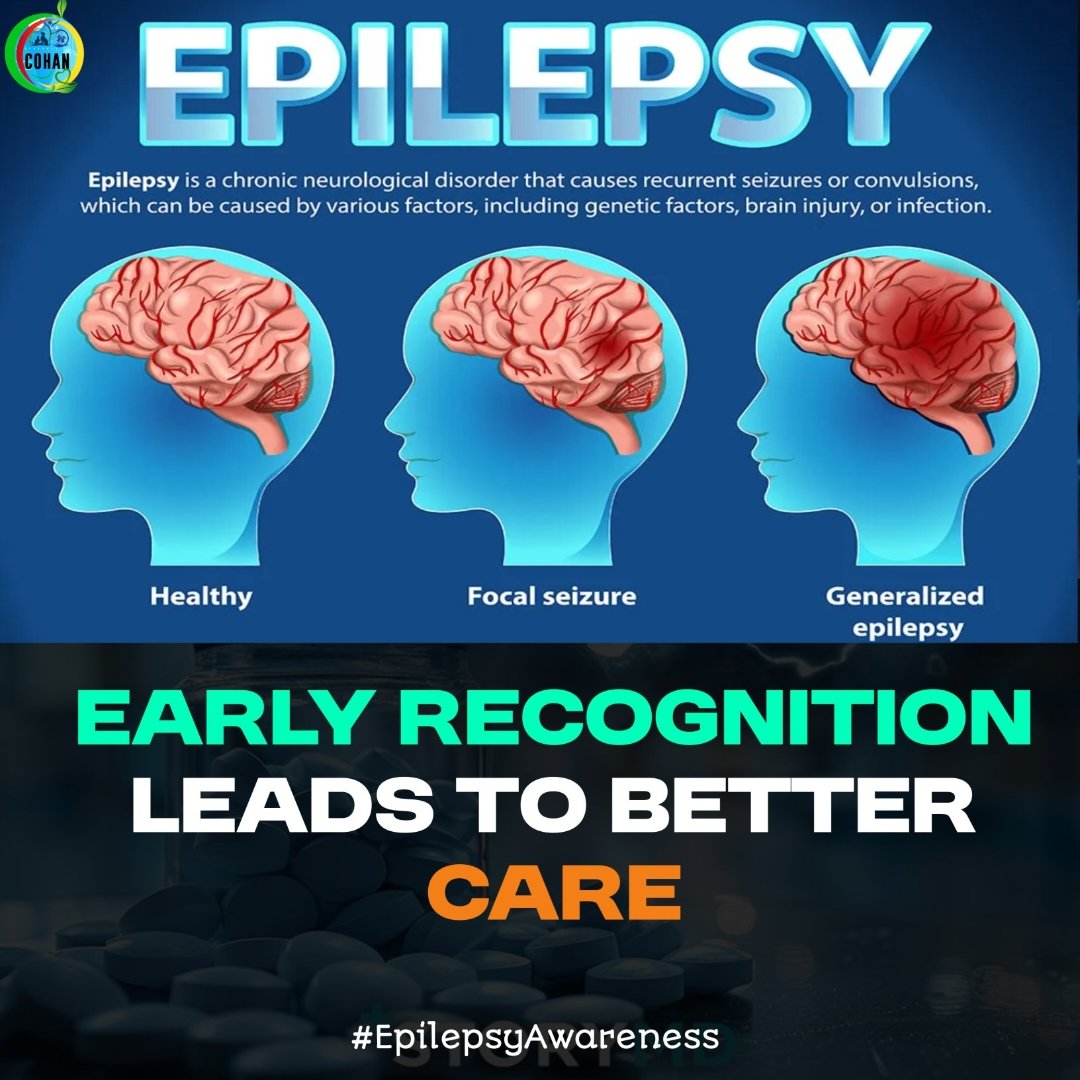 cohan2026's tweet photo. 🟣 Epilepsy: Myths vs Facts 🟣
❌ Epilepsy is contagious
❌ It’s a curse or possession
❌ People with epilepsy can’t work or study
❌ Restrain someone during a seizure
✅ Epilepsy is a brain condition
✅ With treatment, people live normal lives
✅ Keep them safe — don’t restrain https://t.co/qKwI3FUKs6