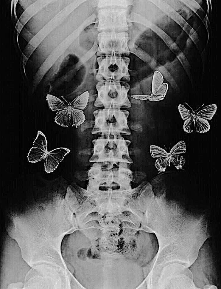 ☤

——— 𝟷𝟷.𝟶𝟸. 𝖳𝗁𝖾𝗒'𝗋𝖾 𝗇𝗈𝗍 𝖻𝗎𝗍𝗍𝖾𝗋𝖿𝗅𝗂𝖾𝗌, 𝗂𝗍'𝗌 𝗒𝗈𝗎𝗋 𝖻𝗋𝖺𝗂𝗇 𝗈𝗇 𝖺𝗅𝖾𝗋𝗍. 
 #𝐓𝐮𝐫𝐧𝐨𝐒𝐚𝐧𝐌𝐮𝐧𝐠𝐨 #𝐒𝐌𝐋𝐎𝐕𝐄