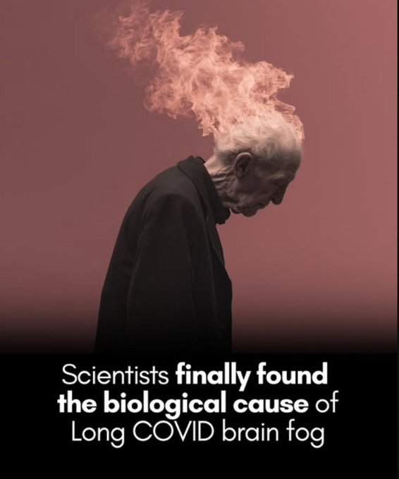 Long COVID brain fog is real — and now, we know what’s causing it.

A breakthrough brain scan reveals the science behind the symptoms.

Scientists in Japan have identified a biological cause behind the cognitive “brain fog” experienced by many Long COVID patients—a breakthrough