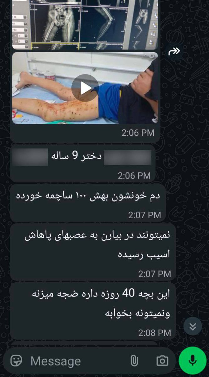 IranianCongress's tweet photo. 🔞🔞🔞
حاوی صحنه دلخراش

دختر ۹ ساله اصفهانی در مقابل خانه اش با گلوله های ساچمه ای پاسداران ولایت خامنه ای زخمی شده و ۴۰ شبانه روز هست که ضجه میزند.

+نیروهای ریزشی کیوآرکدی کجا هستند که به این بچه کمک کنند؟ https://t.co/XVNEkpoiwF