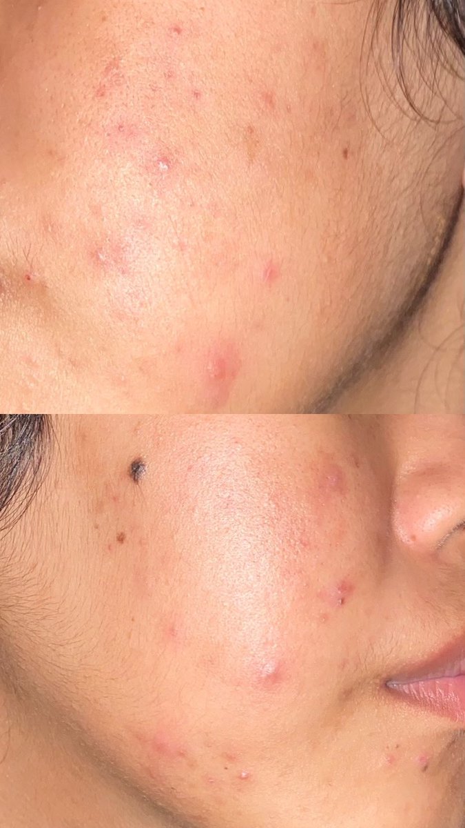 🩷 WOMANFEEDS 🩷 tweet media