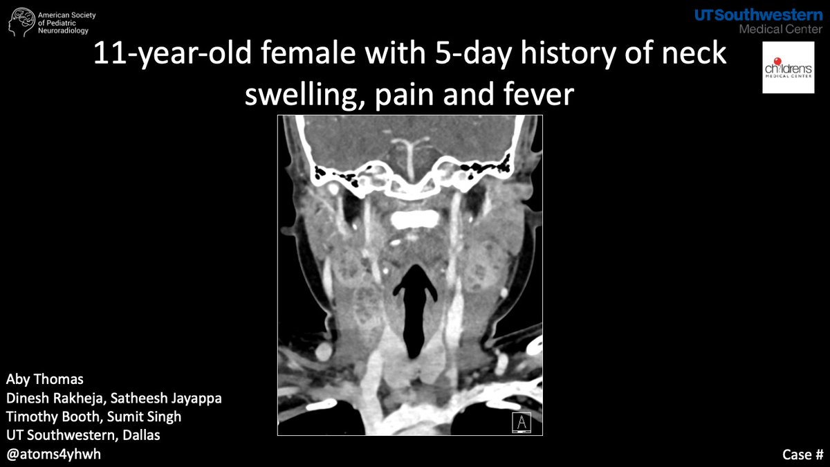 American Society of Pediatric Neuroradiology tweet media