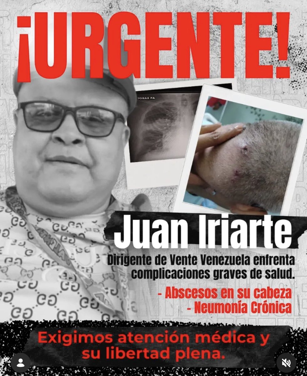 Alarmado con el ensañamiento contra mi pana Juan Iriarte, dirigente de <a href="/VenteVenezuela/">Vente Venezuela</a> #Vargas y con quien compartí celda en El Helicoide, no les bató con trasladarlo el año pasado a Yare a pesar de estar operado del corazón sino que ahora cuando padece neumonía crónica se lo