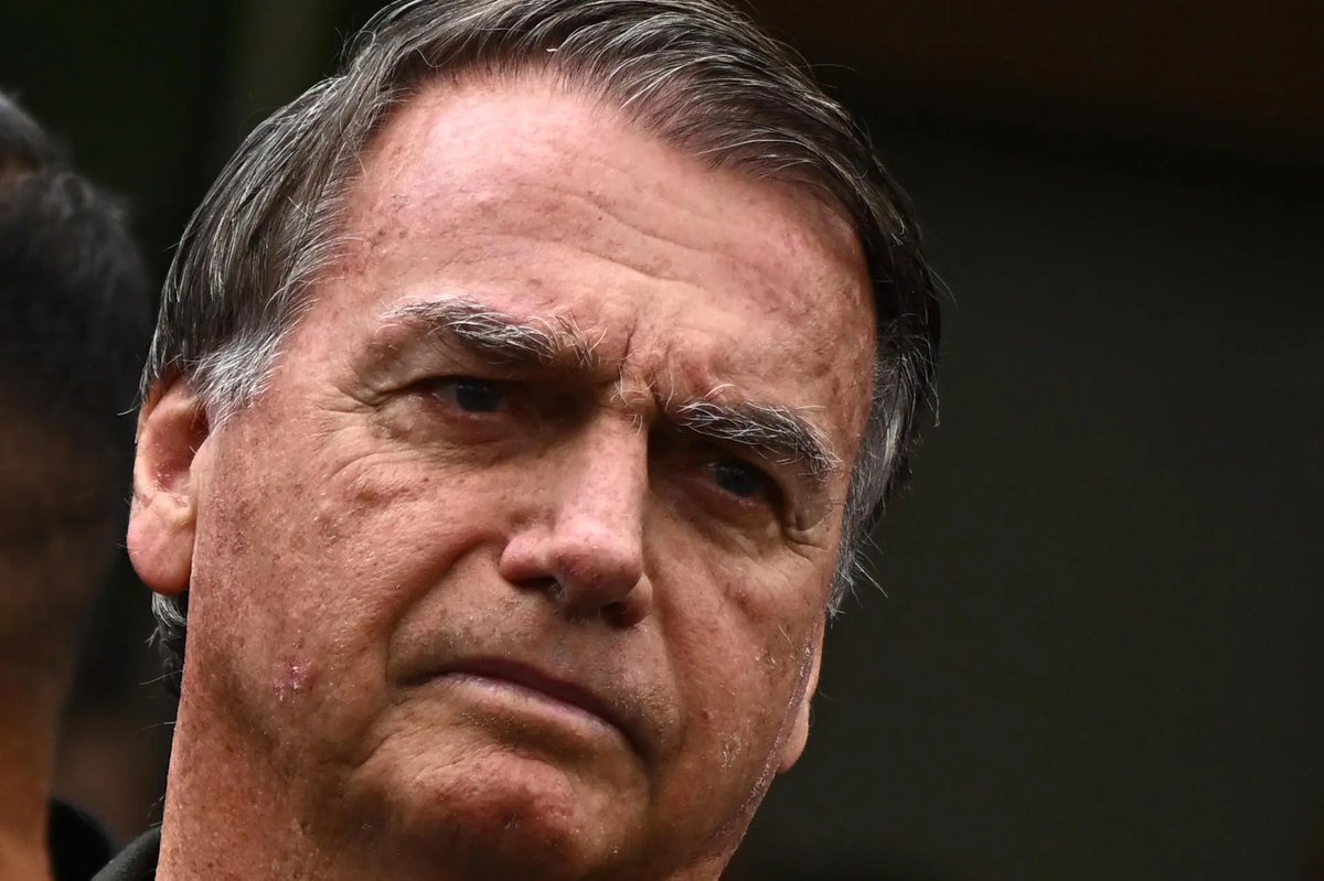 Saio mais um dia deixando meu pai preso de forma desonesta.

Deixo a Papuda com o Presidente Jair Bolsonaro enfrentando mais uma noite difícil, marcada por suas condições crônicas de soluço. Ele me contou que o problema persistiu durante toda a madrugada - algo que naturalmente