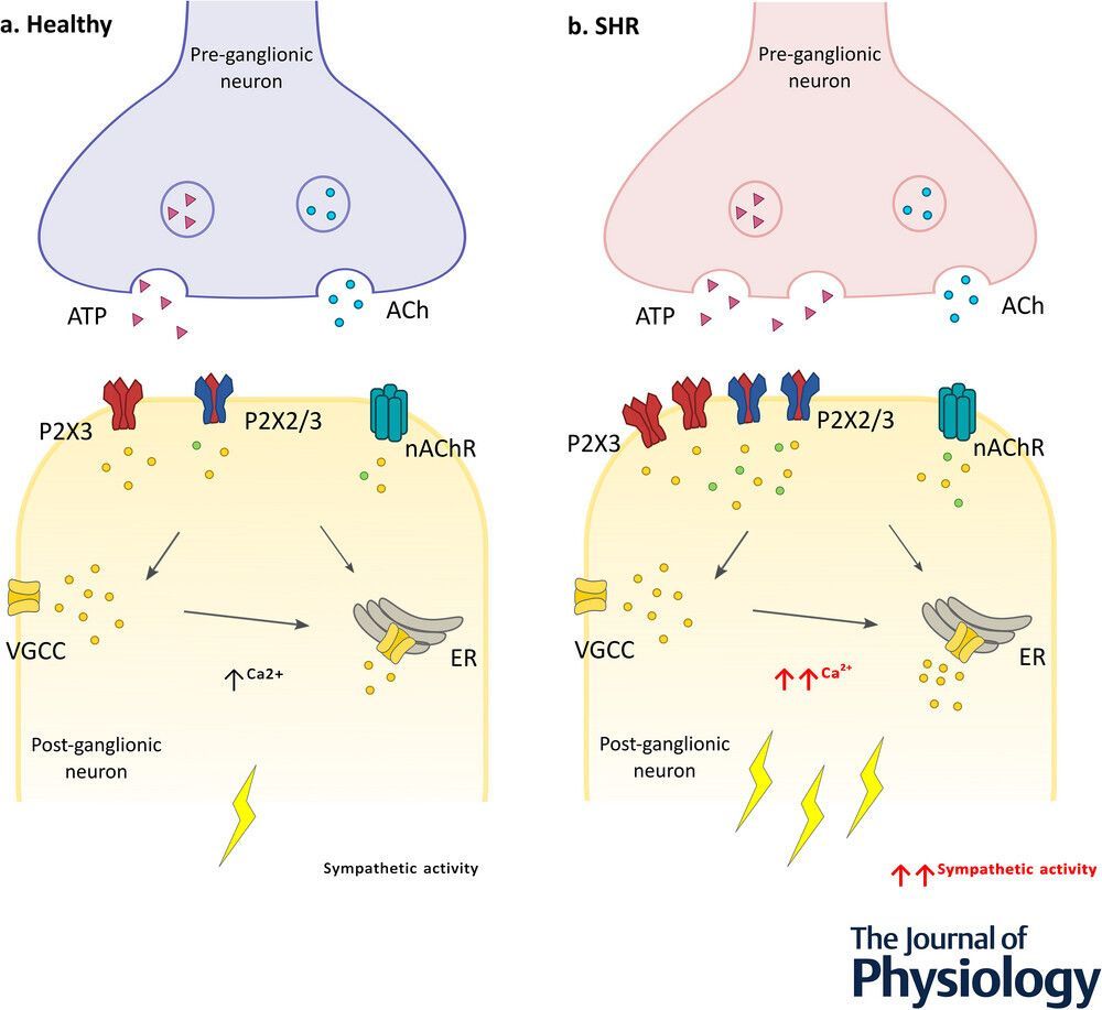 JPhysiol's tweet photo. In this recent study, @DrCarolBussey and colleagues from @FMHS_UoA
investigated anti-#arrhythmic targeting of sympathetic stellate ganglion #P2X3 receptors 🫀 🔬
Read the #Research: https://t.co/iTgTtUtcBv https://t.co/kKIQ8WWVdo