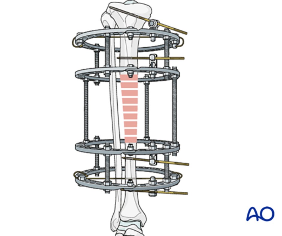 AO Surgery Reference tweet media