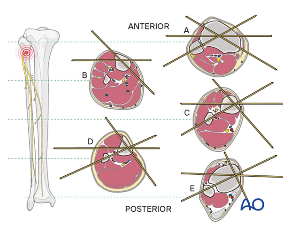 AO Surgery Reference tweet media