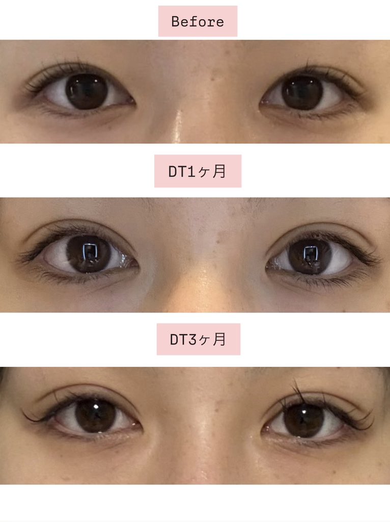 顔面弱者さん🎀 tweet media