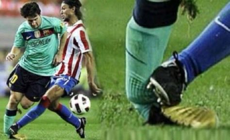 Ronaldo’s career would have ended if he suffered this kind of injury