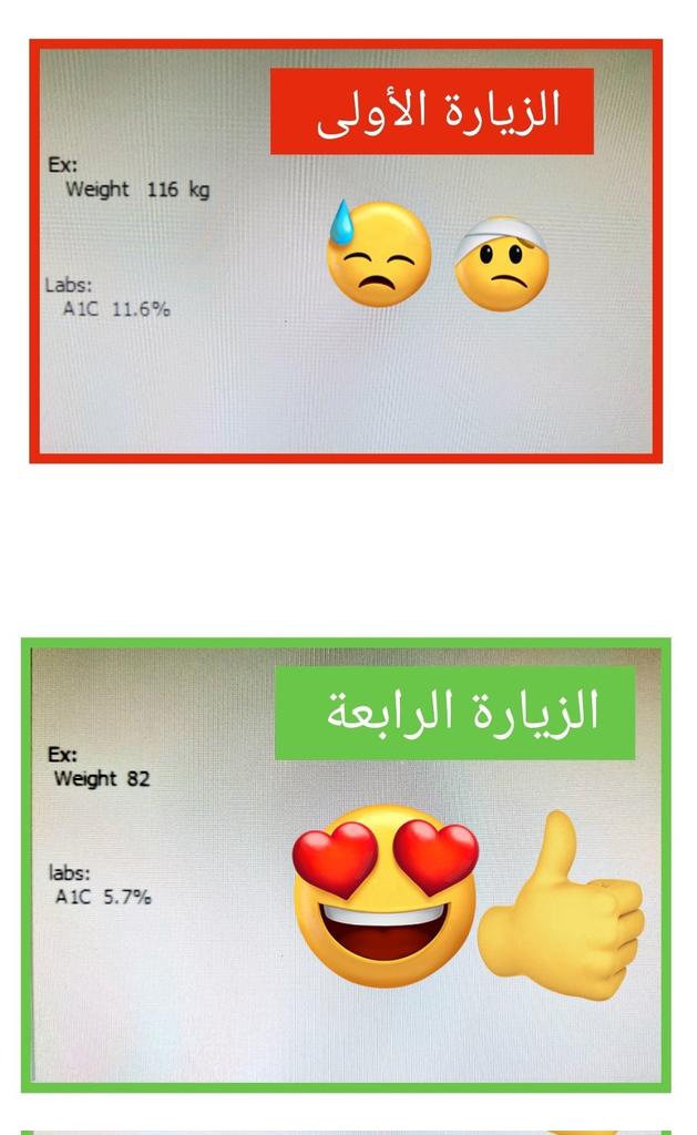 DrAAB1987's tweet photo. حالة مفرحة من عيادتي 🤩 : 

مصابة بالسكري والسمنة، كانت :
- تستخدم إبر انسولين يوميا 
- الوزن  ١١٦ كج  ⛔️
- السكر التراكمي ١١.٦%  ⛔️

⬇️

حاليا ( بعد عدة زيارات ) :
- الوزن ٨٢ كج ✅️
- السكر التراكمي  ٥.٧% ✅️
- بدون انسولين ✅️ 
ما شاء الله تبارك الله 

● السبب:
بعد فضل الله، اختيار الخطة العلاجية المناسبة للمريضة و التزام المريضة 
بالأكل الصحي والرياضة 👍 

.