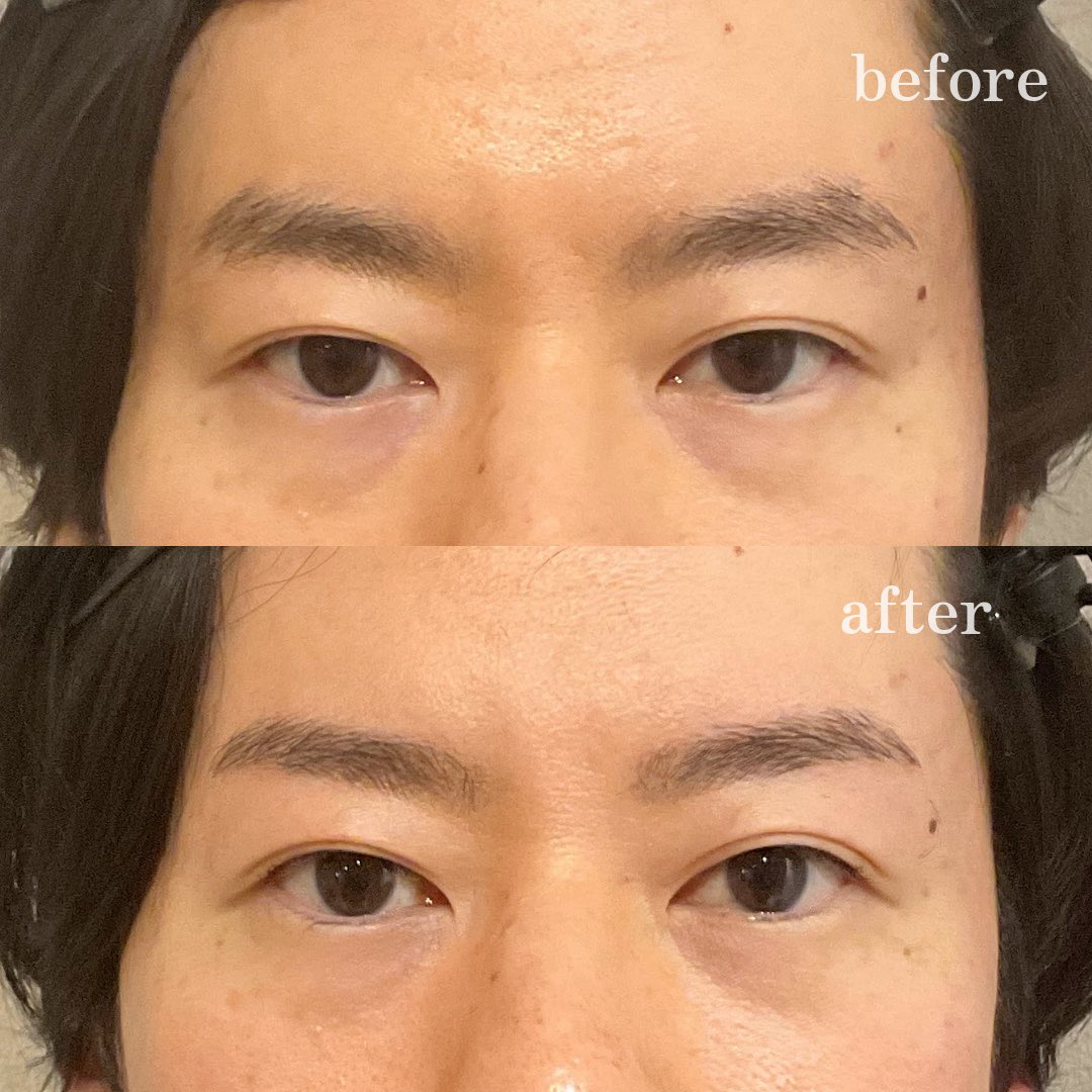 ginza_ace's tweet photo. メンズ眉毛サロン銀座ACE
【銀座二丁目店限定】

新人スタッフ担当の
眉スタイリングを特別価格でご案内中◎

¥3,800／期間限定
仕上がりは、
先輩スタッフが最終チェックを
させていただきます。

新人育成のためのメニューにつき、
今後価格改定予定です。
追加料金なしでご利用いただけます😌 https://t.co/PDUmP4DHbd