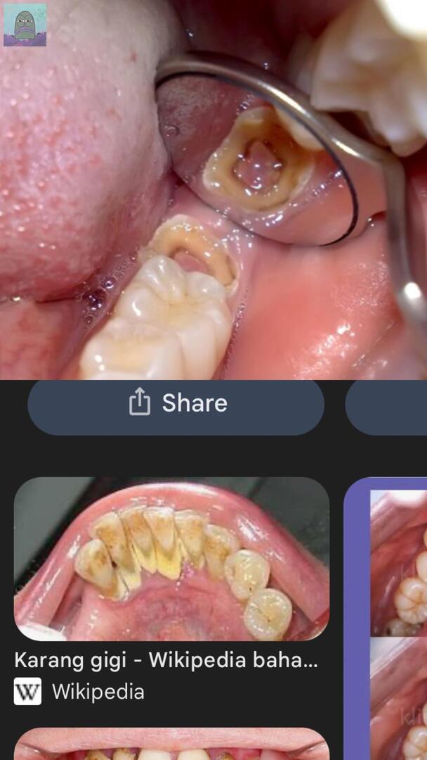 Tanyarl 💚 tweet media