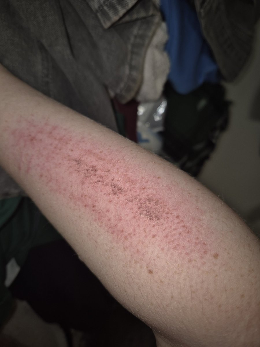 Xiao of Shedtwt tweet media