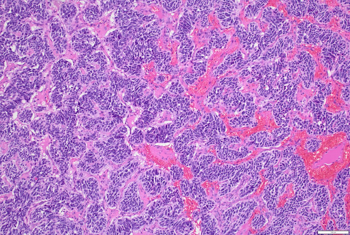 Humberto Trejo Bittar, MD, FCAP tweet media