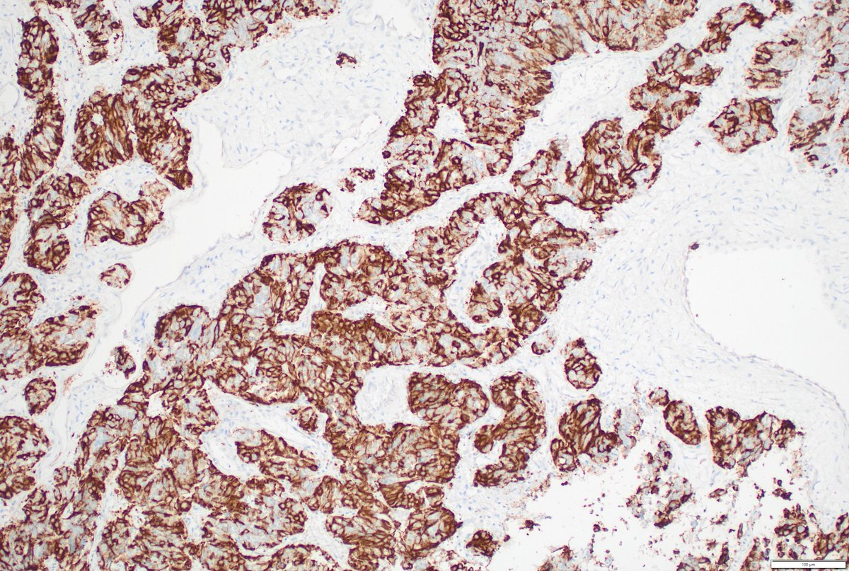 Humberto Trejo Bittar, MD, FCAP tweet media