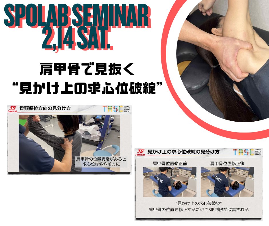 見かけ上の求心位破綻を見抜く