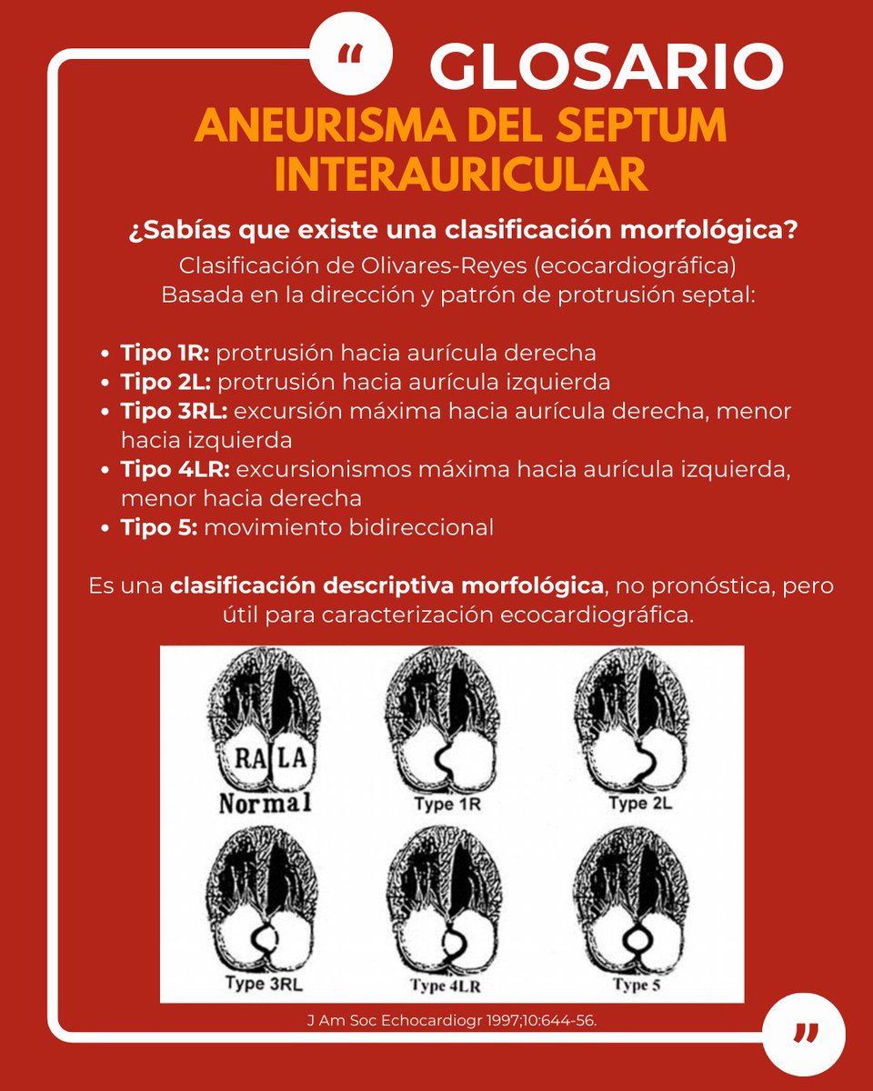 SONECOM_AC's tweet photo. 📘 Aneurisma del Septum Interauricular
Dilatación localizada del septum (usualmente en la fosa oval) que protruye hacia una o ambas aurículas, con movimiento excesivo.
Puede asociarse a FOP y eventos embólicos.
#SONECOM #GlosarioSONECOM #Ecocardiografía https://t.co/gAlcc82tpd