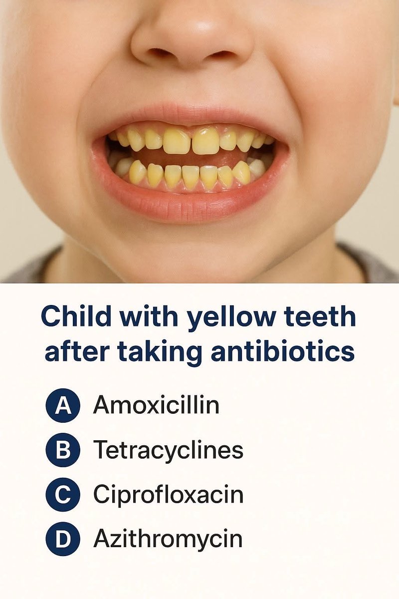 Yellow discoloration of teeth is the Side effect of which antibiotics?