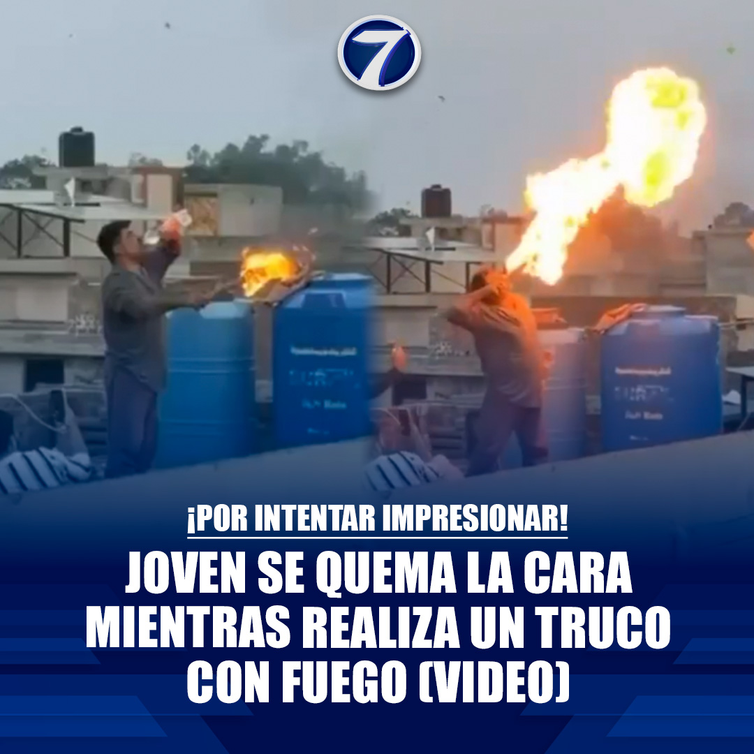 Noti7Guatemala's tweet image. 🔥 ¡Por intentar impresionar! Joven se quema la cara mientras realiza un #truco con fuego (VIDEO) ➡ bit.ly/4qGQWj6