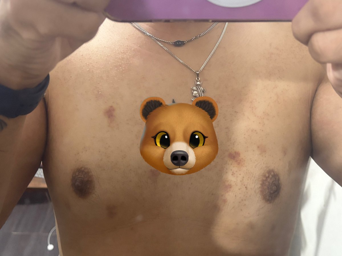 thehotva's tweet photo. Is this a plot twist

#AlterNaic #Kissmarks #hickies #Chubby https://t.co/eNF4ux0XW7
