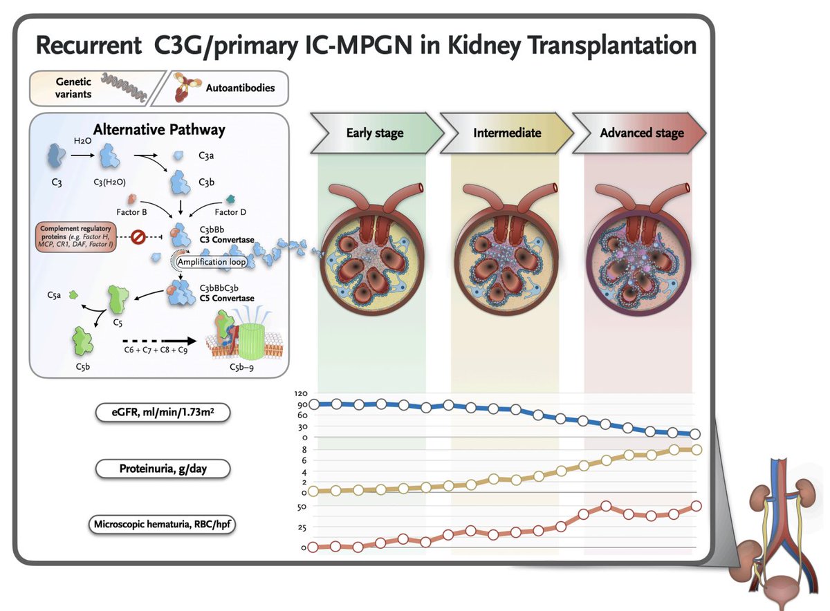 Recurrence of C3 Glomerulopathy and Immune Complex–Mediated Membranoproliferative Glomerulonephritis After #Kidney #Transplantation: Challenges and Opportunities

 doi.org/10.1016/j.ekir…

#C3Glomerulopathy  #KIRReview