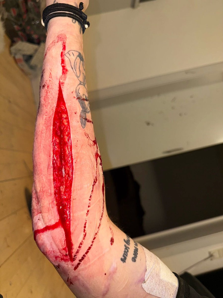 twt_borderline's tweet photo. Cut from today.. my life is falling apart…
#shtwt #988shtwt #slittwt 
Sfx all fake https://t.co/zF0d9dsrON