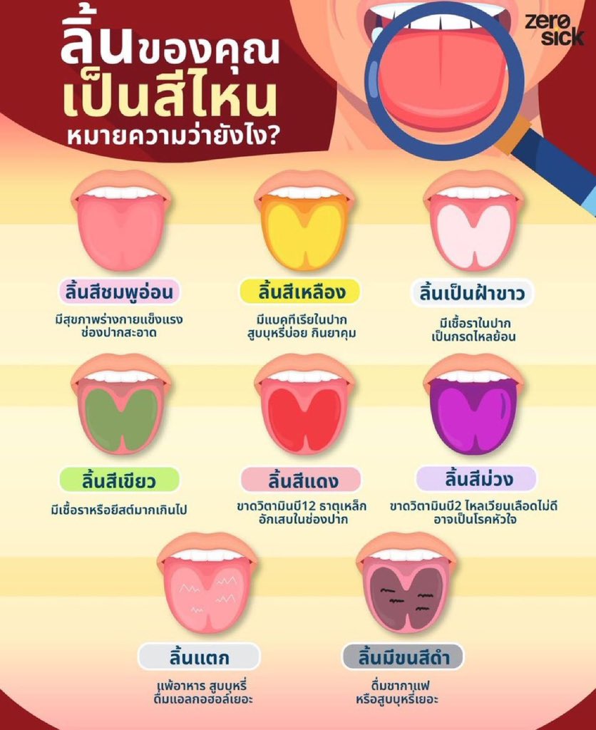 แปะค่ะ เช็คด่วน!!!