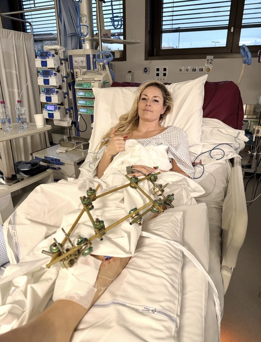 Spitfire tweet media