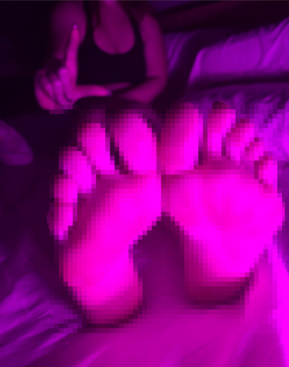 Losers get pixels ONLY