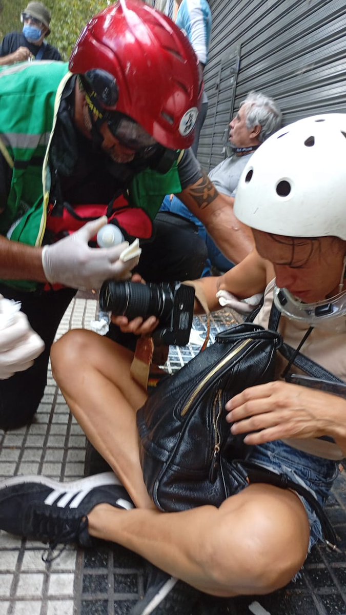 La reportera Rocío Bao de Infonews herida con una bala de goma en el ojo