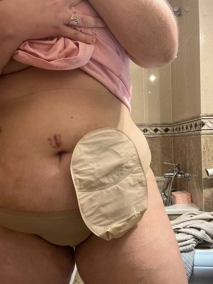 Iris Torrente | Ileostomia & inmunomediadas tweet media