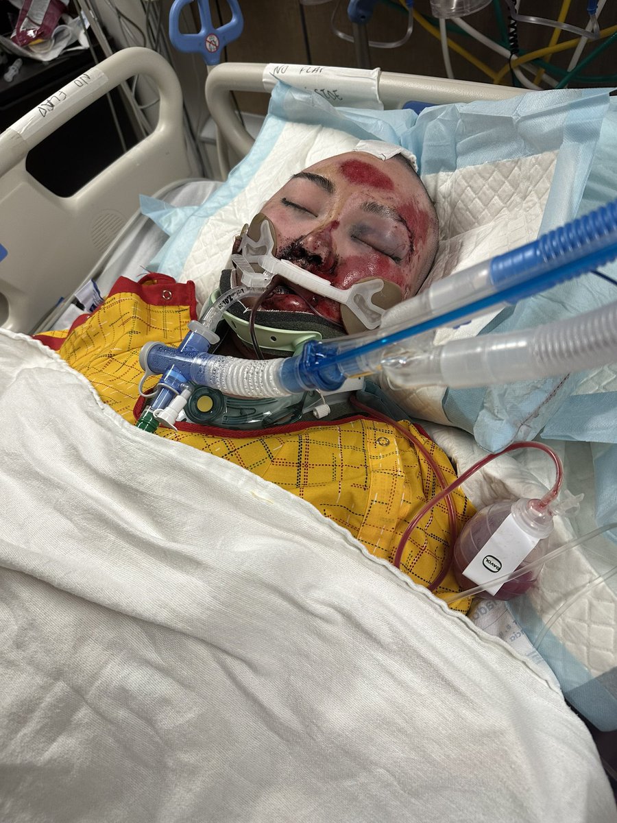 <a href="/nypost/">New York Post</a> Oh, okay. I guess we’ll just look the other way then. 16 years of not even trying to work towards citizenship. Hey <a href="/nypost/">New York Post</a> feel free to say hi to my stepdaughter who is now permanently disabled from an illegal immigrant overstaying her visa and crashing into her motorcycle.