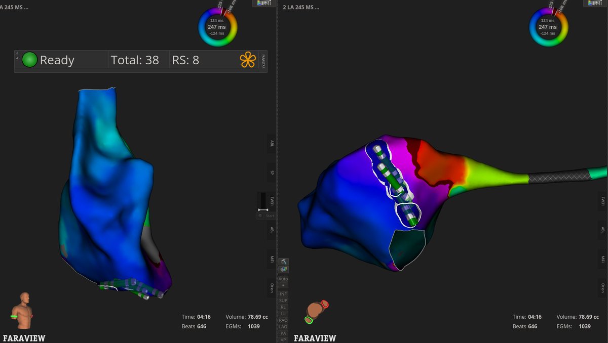 BostonSci Cardiology tweet media