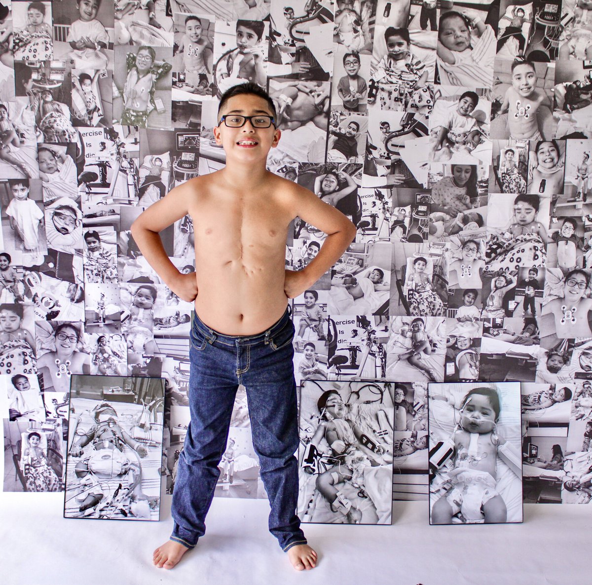 MLH_CHD's tweet photo. It's time to announce our 2026 Rock Your Scar Photo Contest winner in the 9-12 age category🥁
Congratulations to Noah Gallardo, our #RockYourScar2026 winner 🎉
Thank you to all who have entered this category and rocked your scar ❤️
#1in100 #HeartMonth #CHDAwarenessWeek https://t.co/GAEASYiSIM